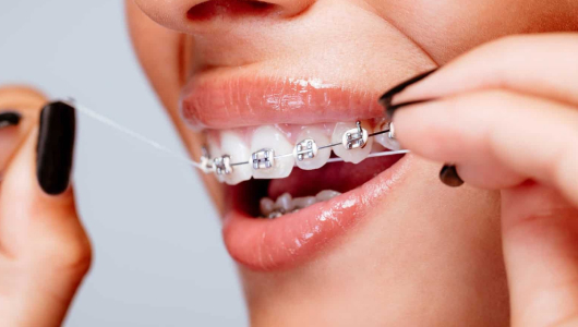 Флосс, зубная нить Флосс, зубная нить